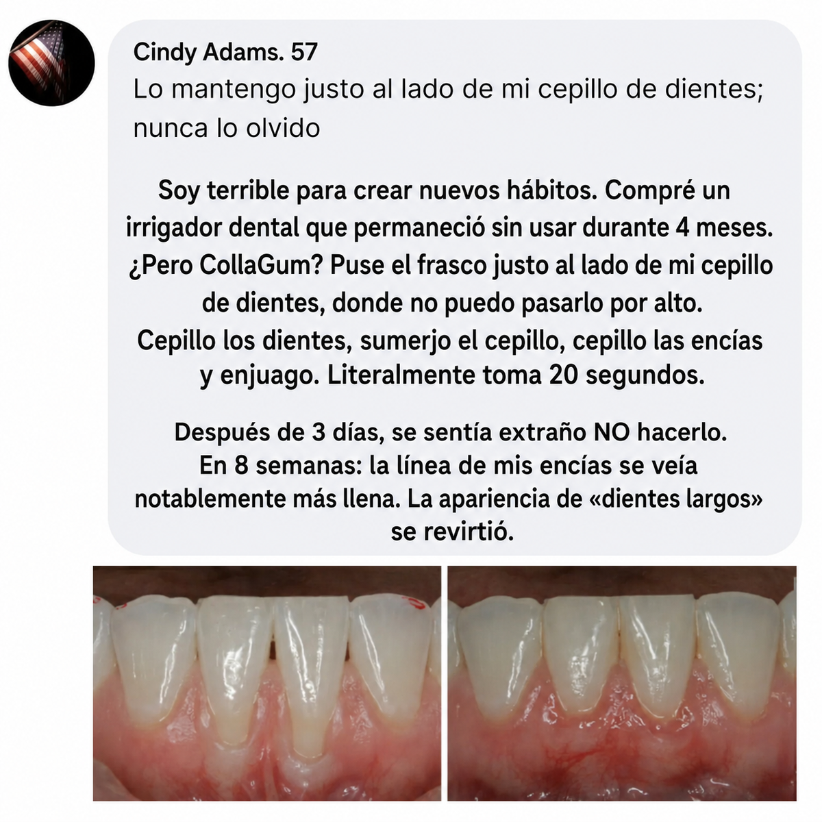 COLLA GUM