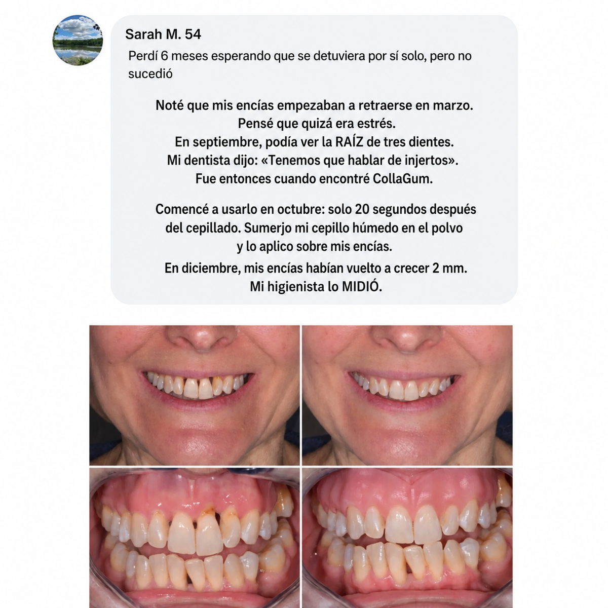 COLLA GUM