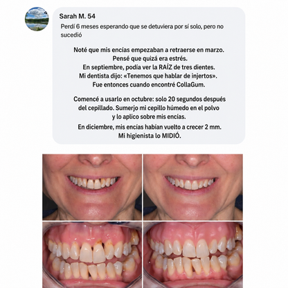 COLLA GUM